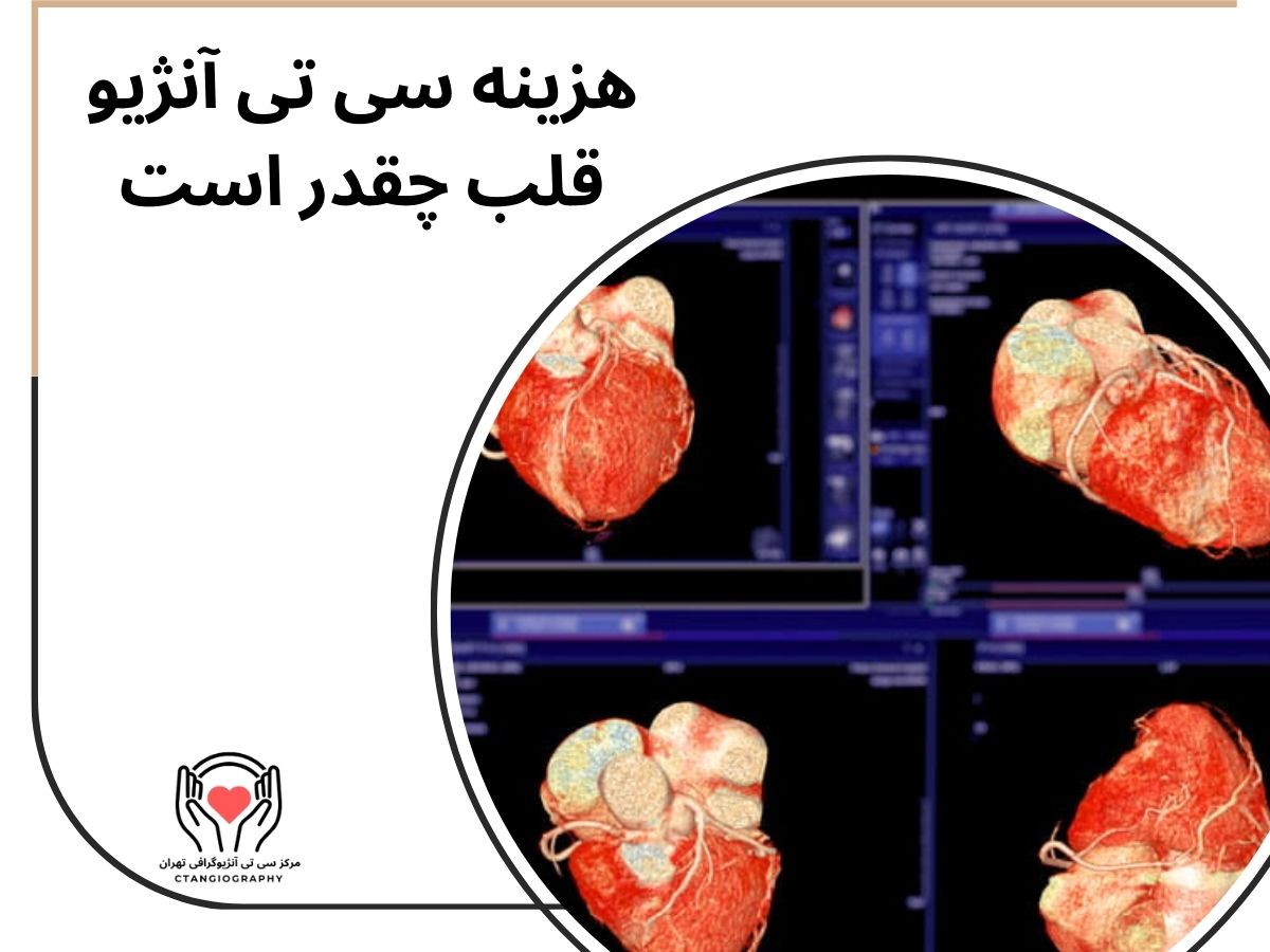 هزینه سی تی آنژیو قلب چقدر است
