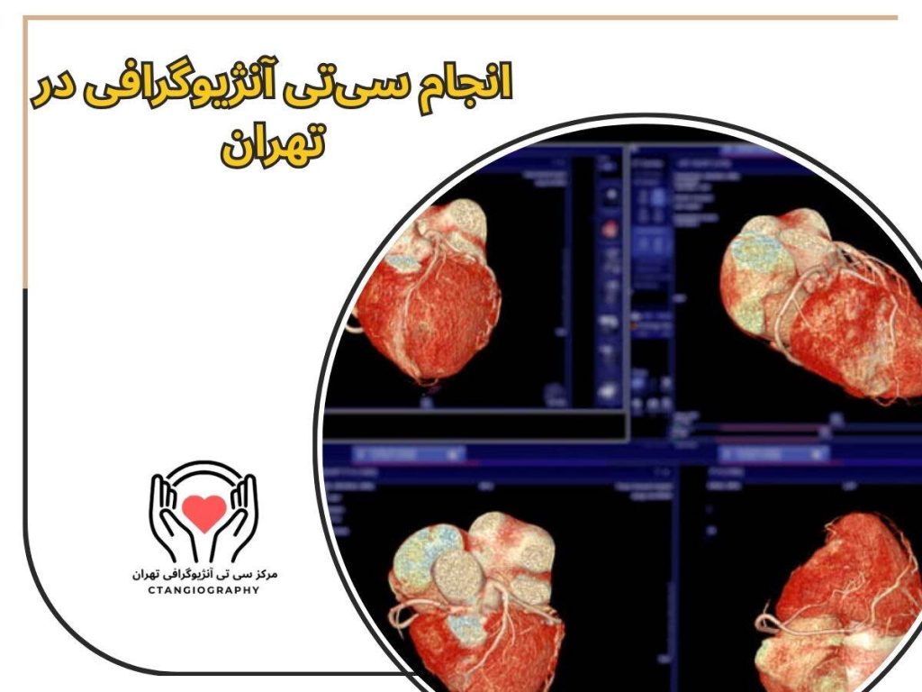 سی تی آنژیوگرافی قلب