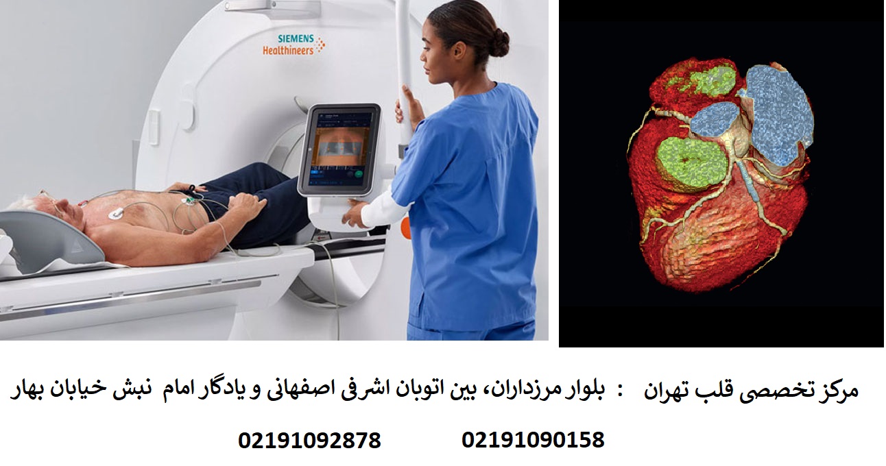 تفسیر سی تی آنژیو قلب به زبان ساده/نمونه گزارش ct آنژیو قلب