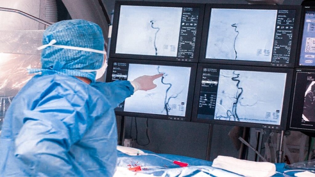 تصویری از جواب سی تی آنژیوگرافی قلب در مقابل خمتخصص در حال تفسیر
