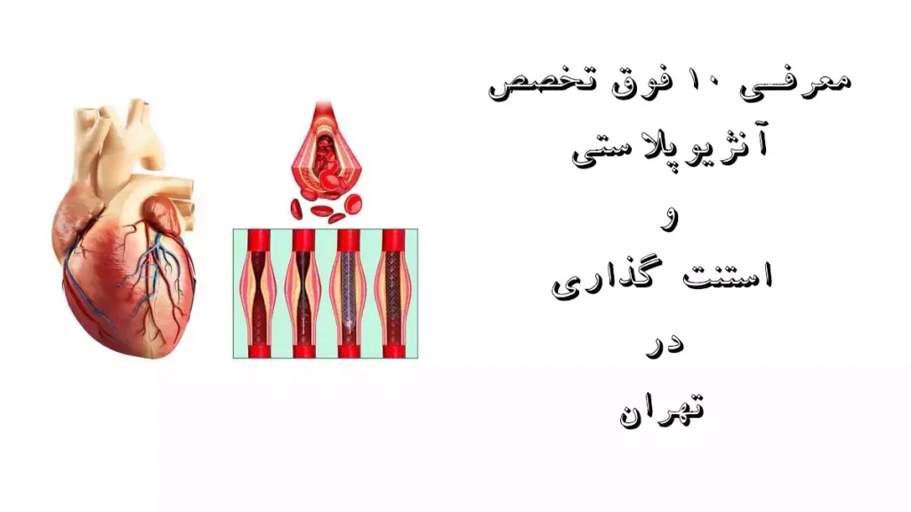 معرفی 10 فوق تخصص آنژیوپلاستی و استنت گذاری در تهران معرفی 10 فوق تخصص آنژیوپلاستی و استنت گذاری در تهران